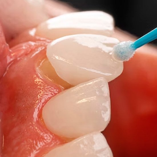 Foto Estética Dental - Dr. Alexandre Esteves